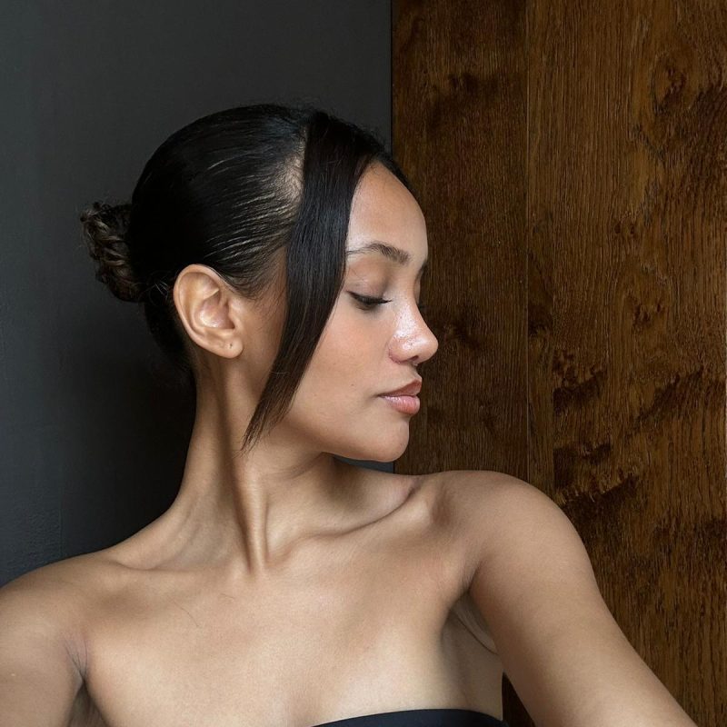 nazli-selvi-rhinoplasty-in-antalya-2