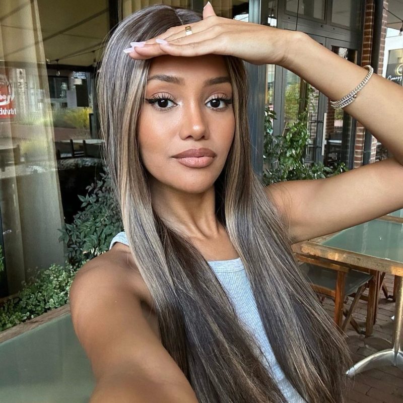 rhinoplasty-in-turkey-before-after